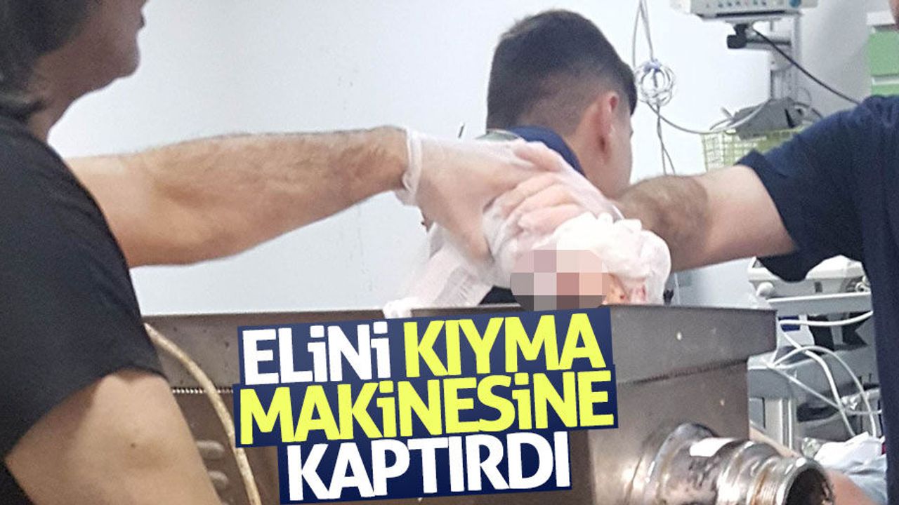 Samsun'da çocuk elini kıyma makinesine kaptırdı