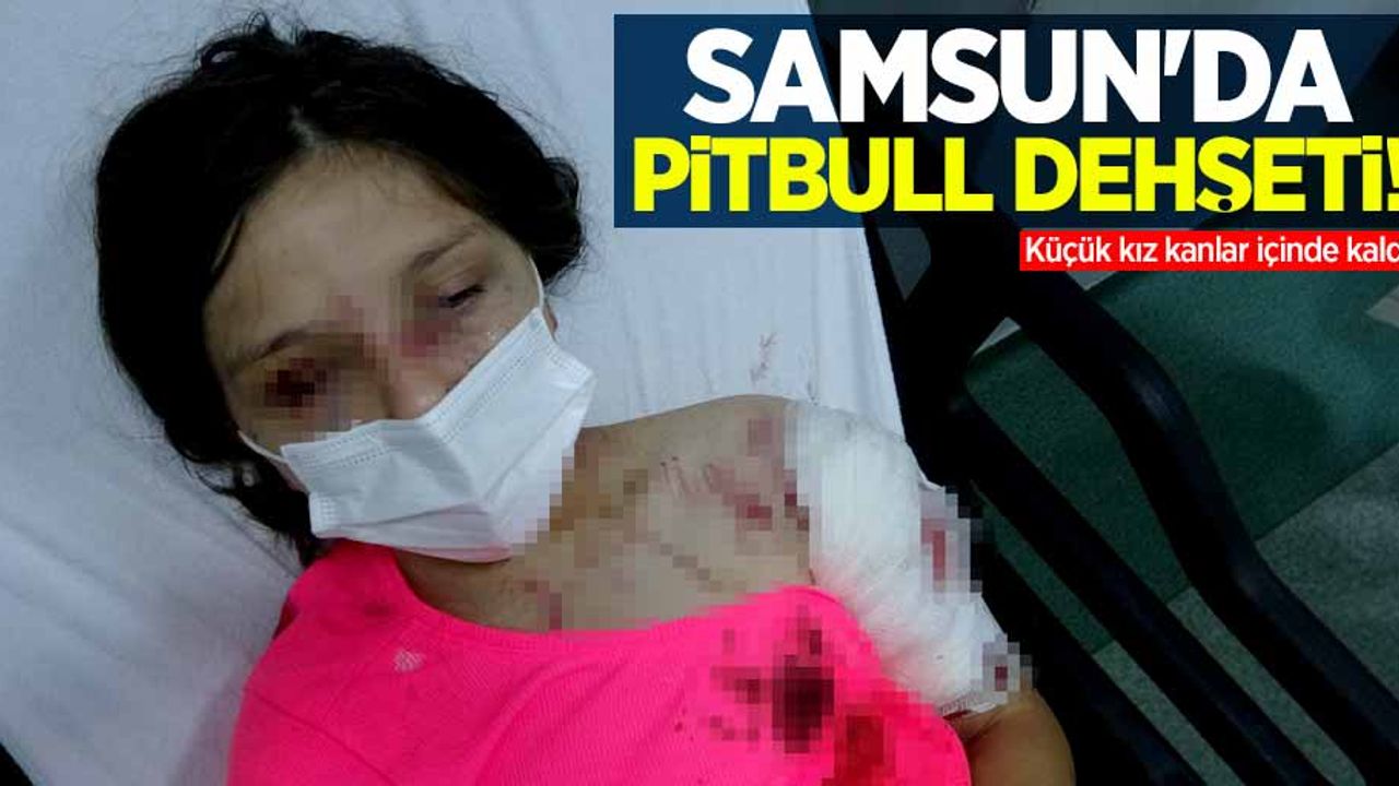 Samsun'da pitbull dehşeti! Küçük kız kanlar içinde kaldı