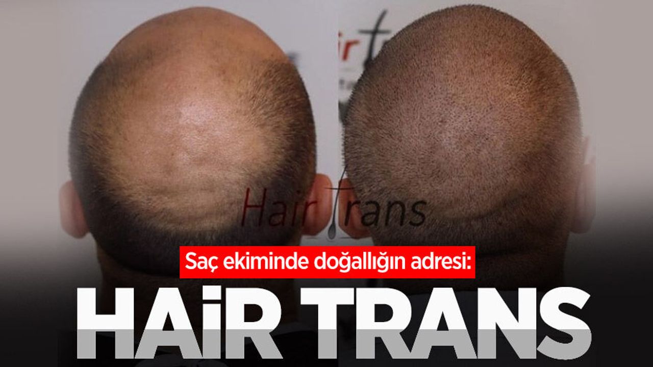 Saç ekiminde doğallığın adresi: Hair Trans