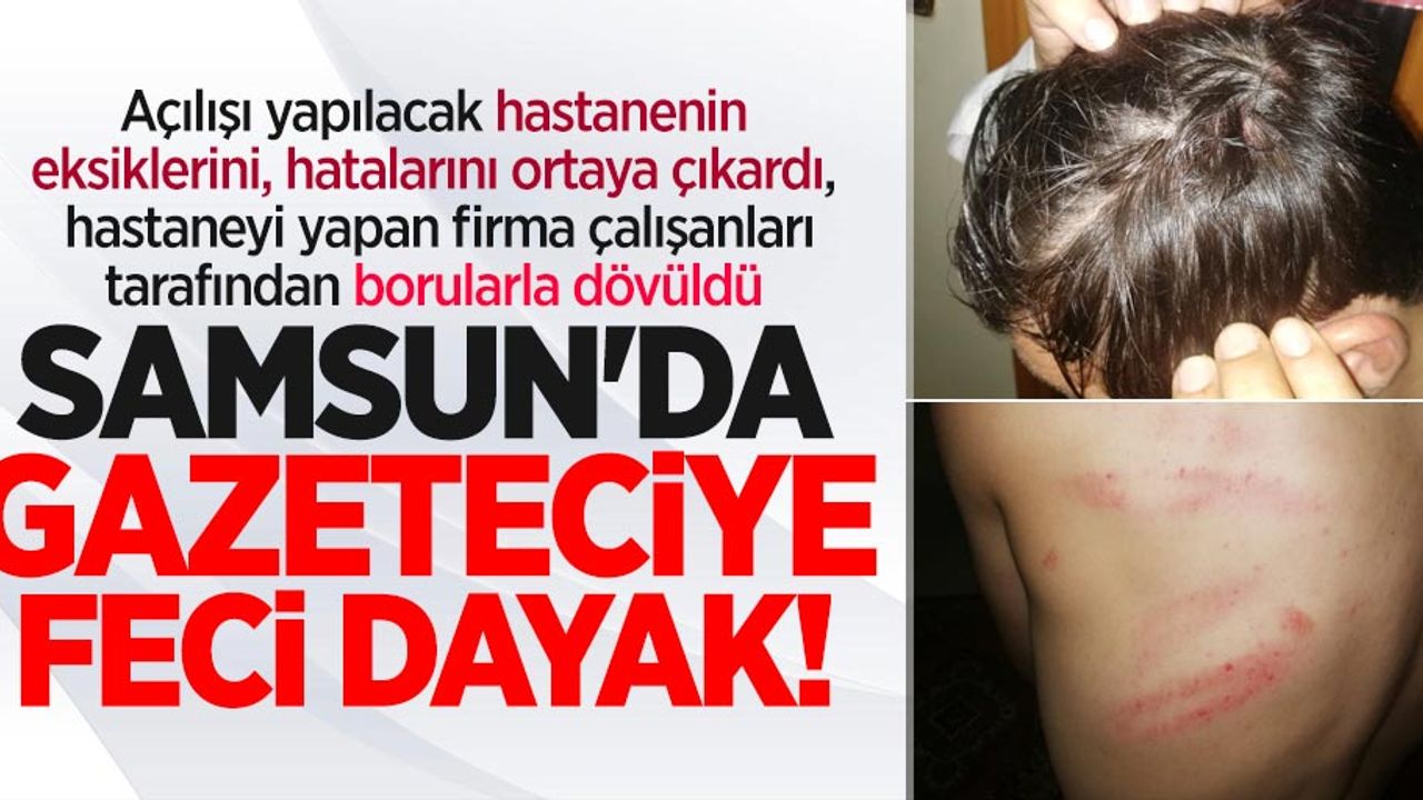 Samsun'da gazeteciye feci dayak! Doğalgaz borusu ile dövdüler
