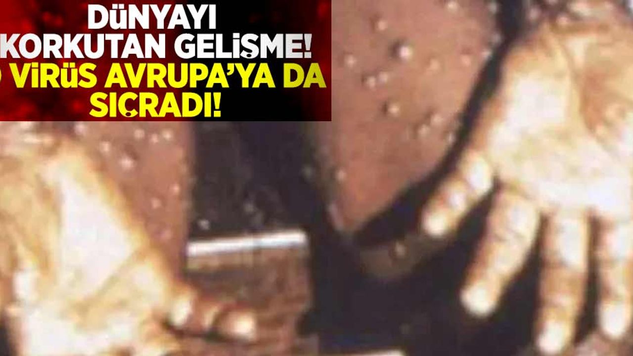 Dünyayı Korkutan Gelişme! O Virüs Avrupa'ya da sıçradı!