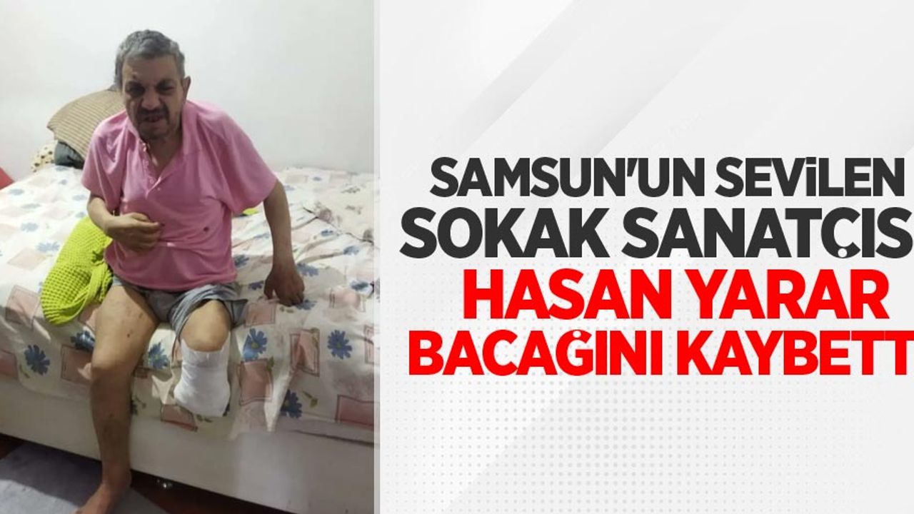 Samsun'un sevilen sokak sanatçısı bacağını kaybetti