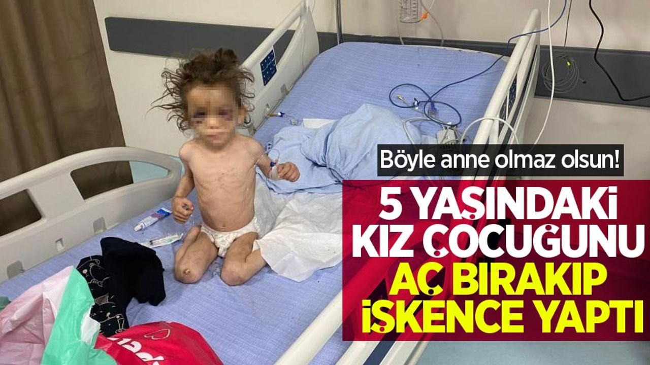 Böyle anne olmaz olsun! 5 yaşındaki kız çocuğunu aç bırakıp, işkence yaptı