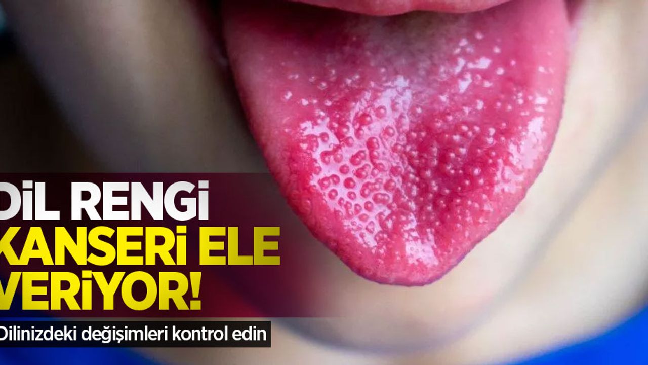 Dil rengi, o hastalığı ele veriyor! Dilinizdeki değişimleri kontrol edin