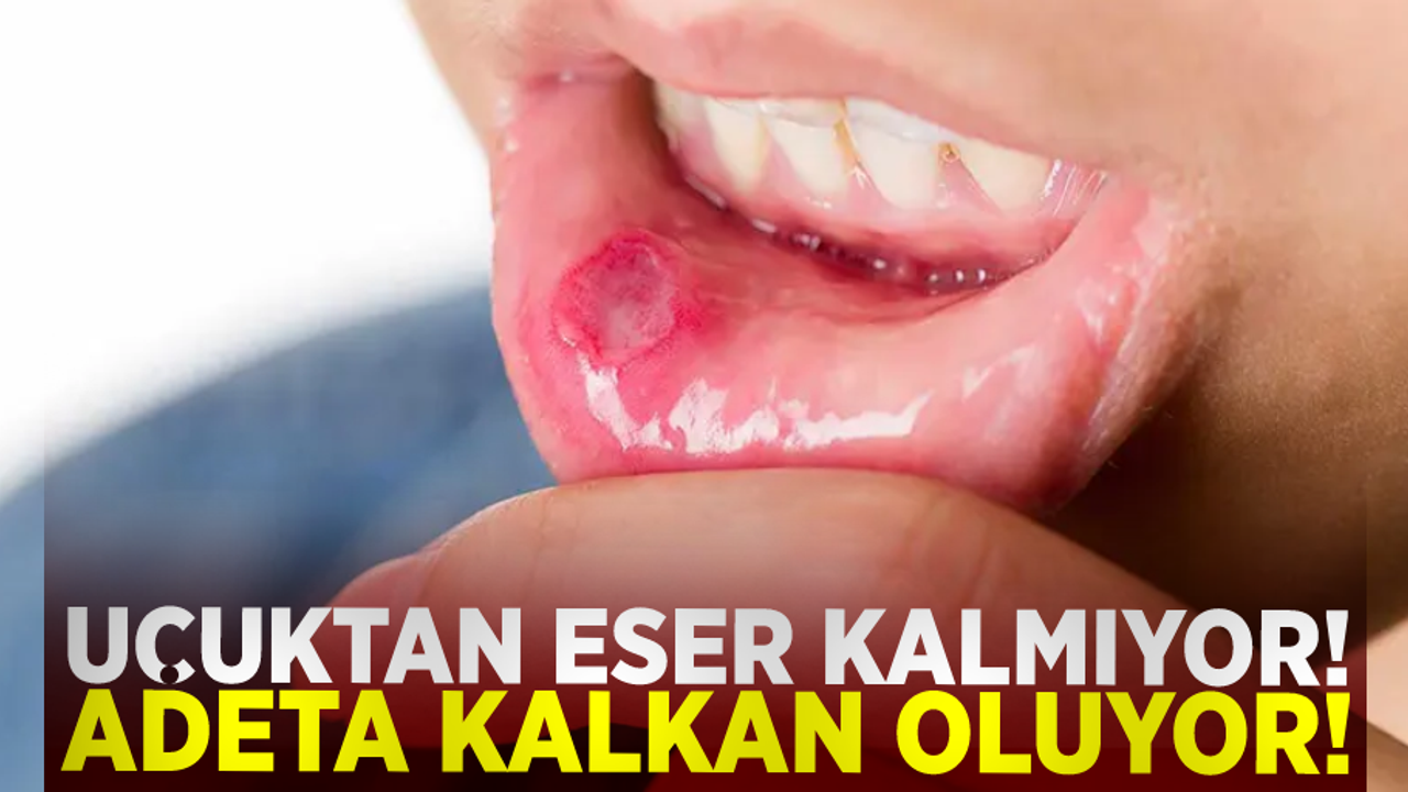 Uçuktan Eser Kalmıyor! Adeta Kalkan Oluyor!