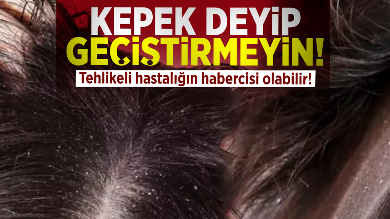 Sakın Hafife Almayın! Ciddi Hastalıkların Habercisi Olabilir!