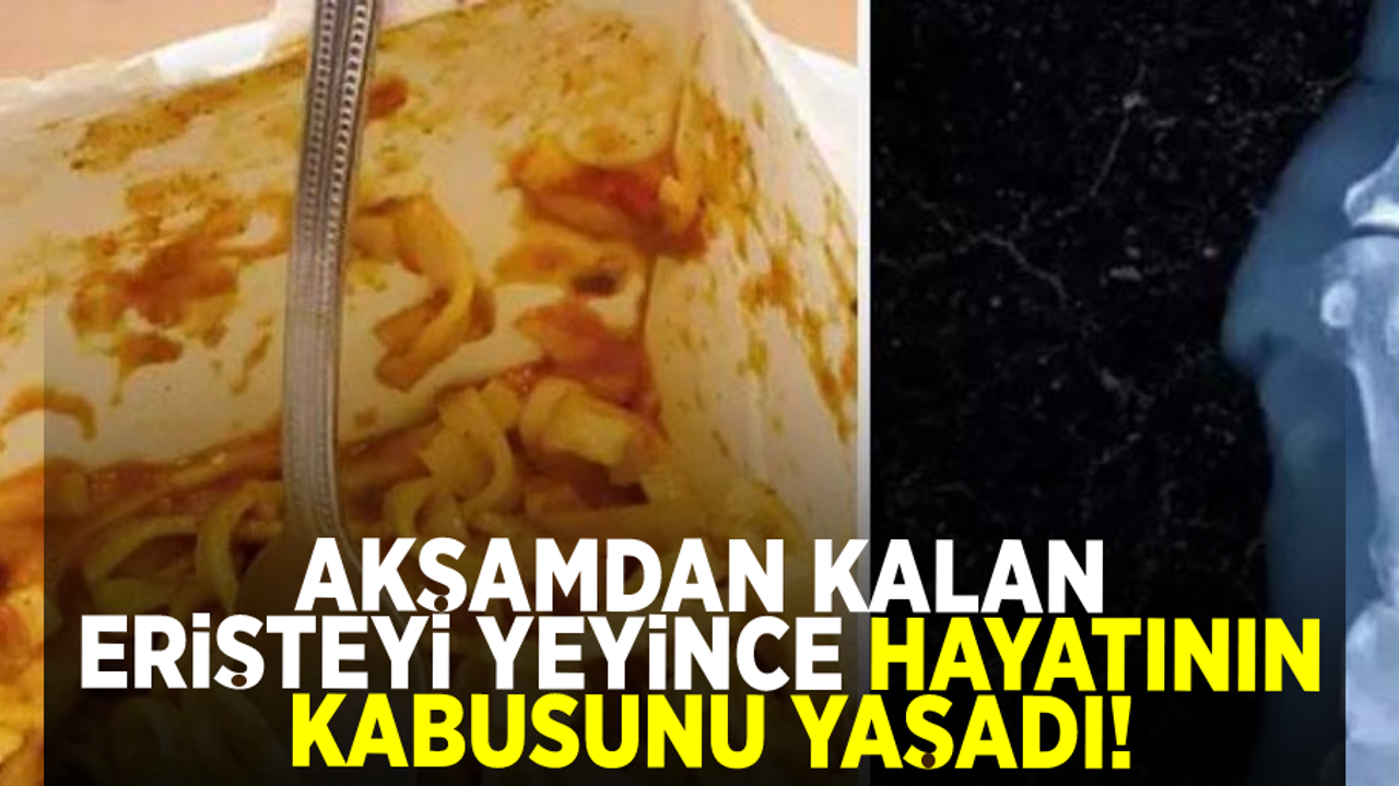 Akşamdan kalan erişteyi yedikten sonra zehirlenen öğrencinin elleri ve bacakları kesildi