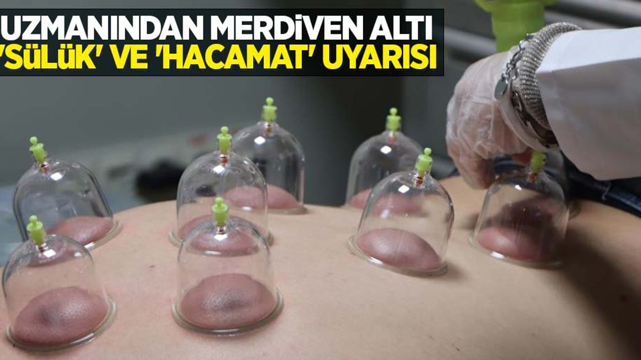 Uzmanından merdiven altı 'sülük' ve 'hacamat' uyarısı
