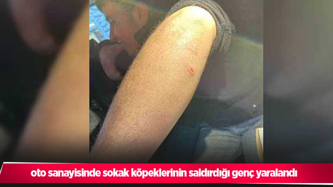 oto sanayisinde sokak köpeklerinin saldırdığı genç yaralandı
