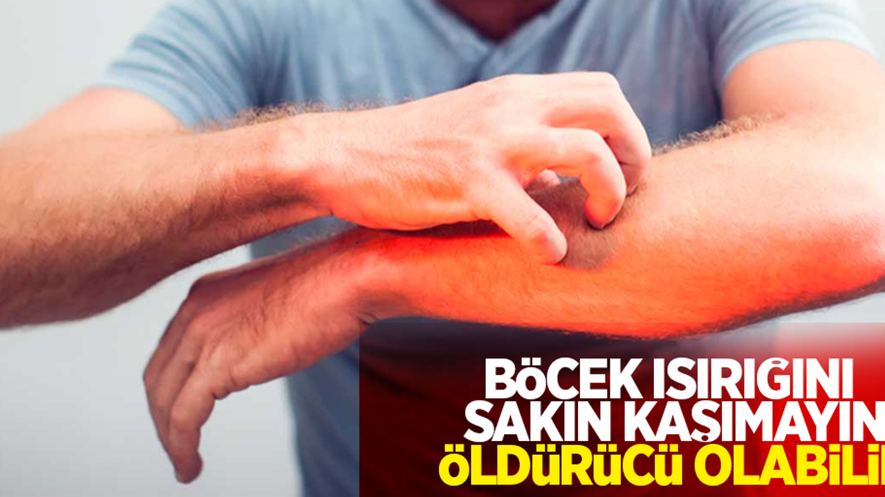 Böcek ısırığını sakın kaşımayın: Öldürücü olabilir!