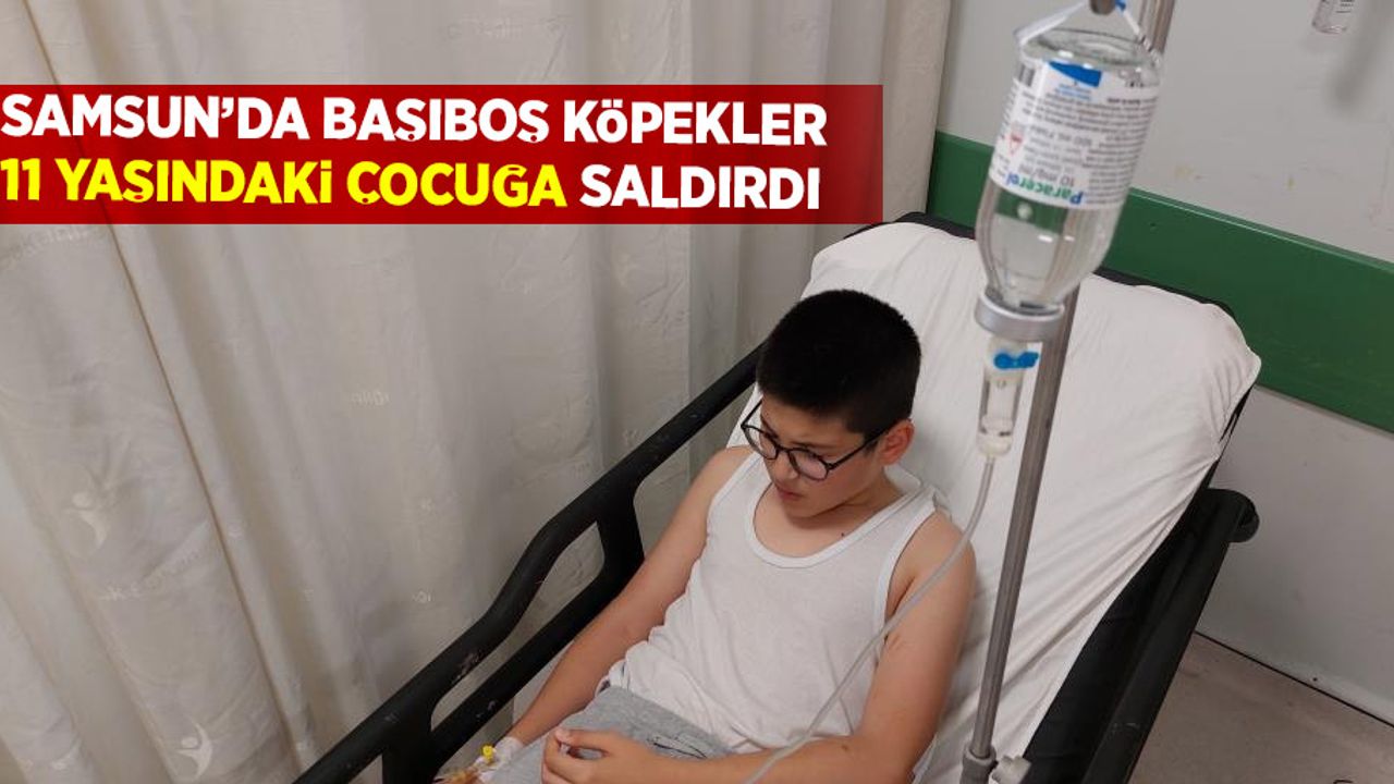 Samsun'da başıboş köpekler 11 yaşındaki çocuğa saldırdı!