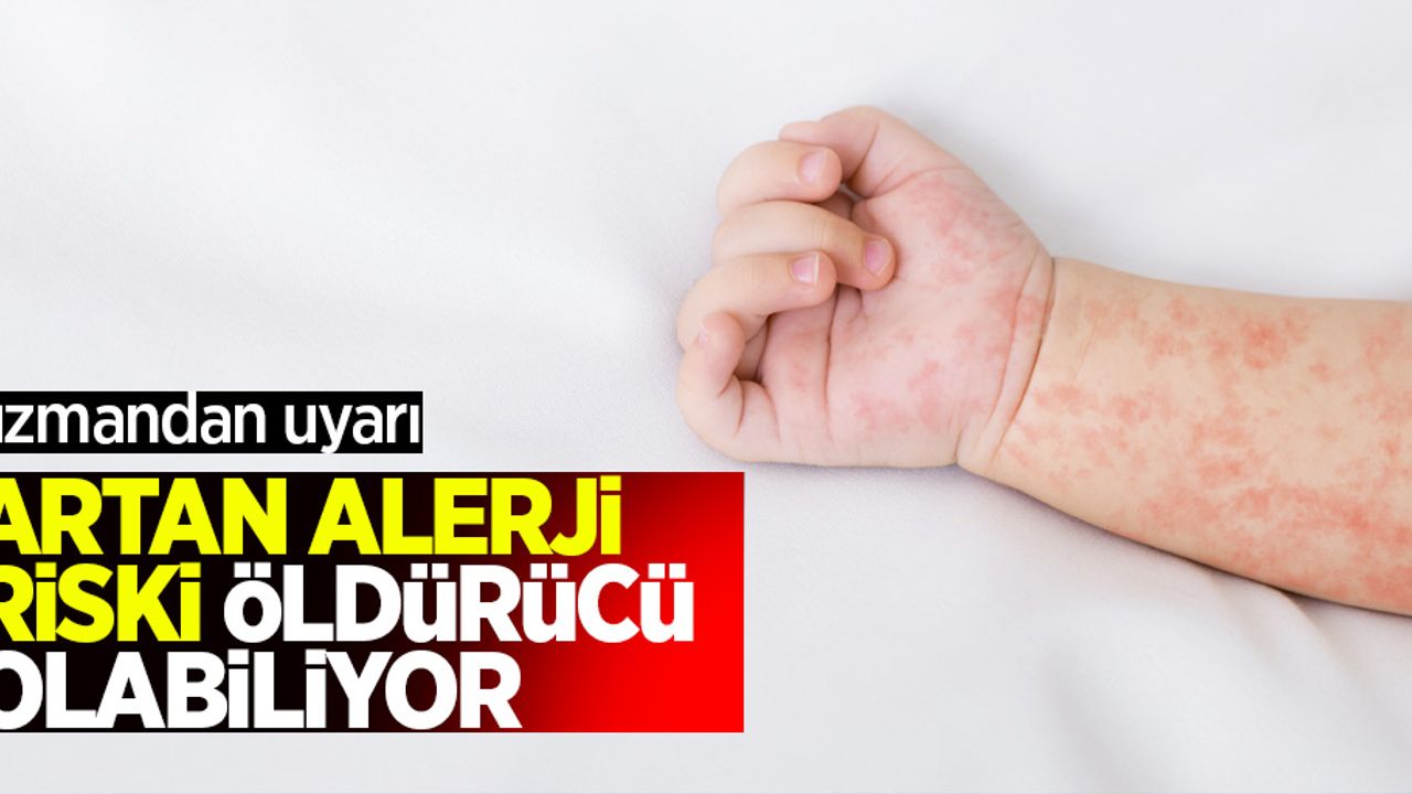 Uzmandan uyarı: Artan alerji riski öldürücü olabiliyor!