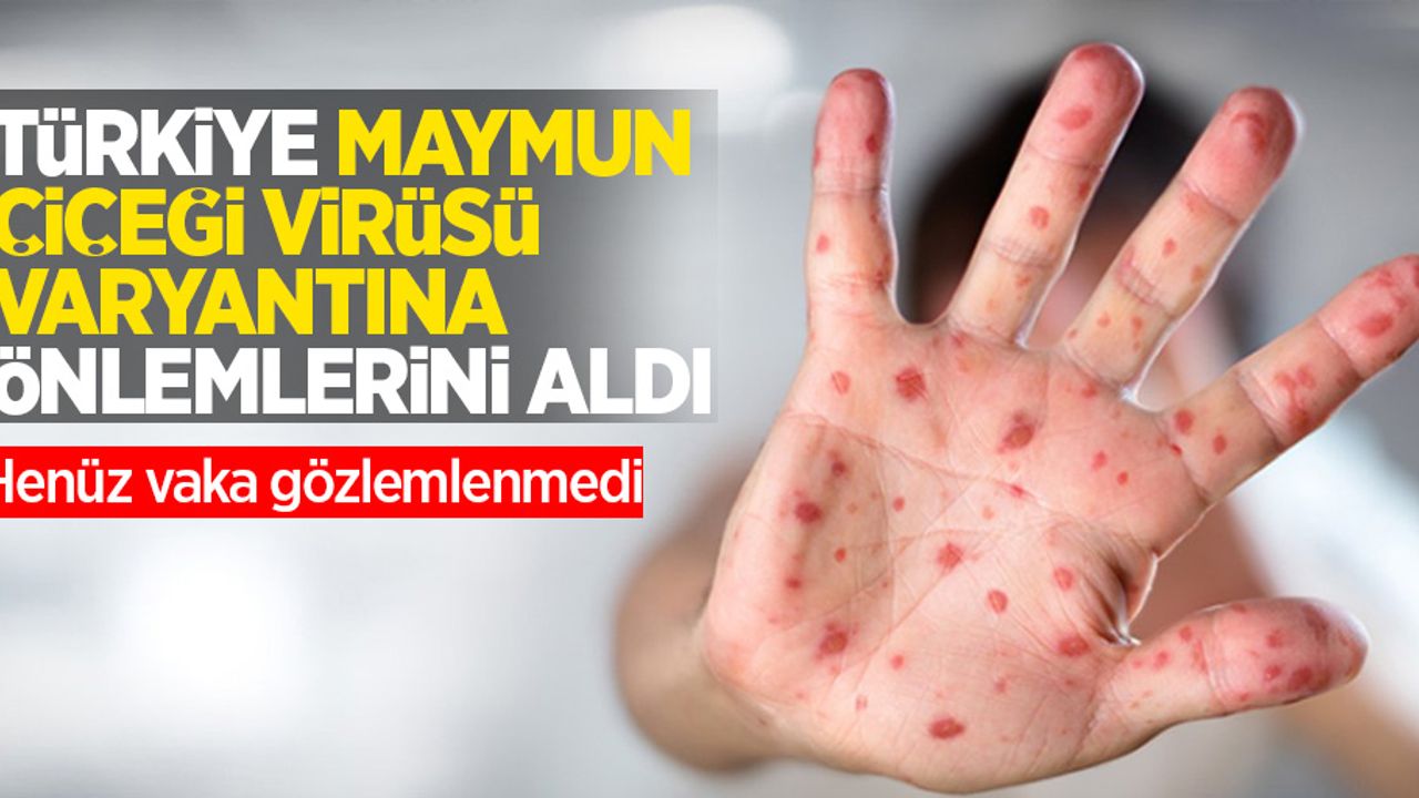 Türkiye Maymun çiçeği virüs varyantına önlemlerini aldı: henüz vaka gözlemlenmedi