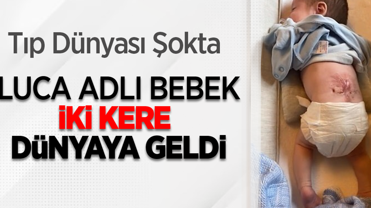 Tıp dünyası şokta: Luca adlı bebek iki kere dünyaya geldi