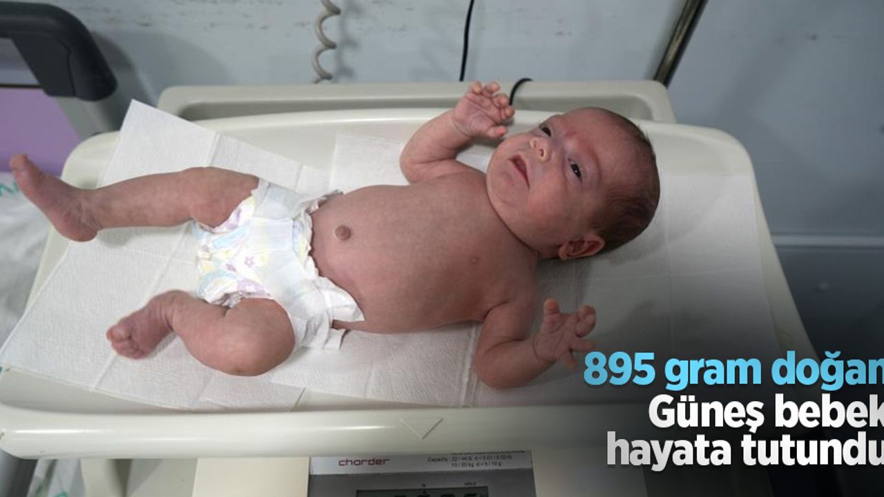 895 gram doğan Güneş bebek hayata tutundu