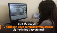 Prof. Dr. Gündüz: 2 haftadan uzun süren ağız yaraları için diş hekimine başvurulmalı.