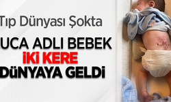 Tıp dünyası şokta: Luca adlı bebek iki kere dünyaya geldi