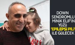 Down sendromlu minik Elif'in yüzü 'epilepsi pili' ile gülecek