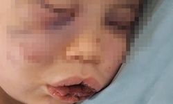 Vahşeti yaşayan 2 yaşındaki bebek hastanelik oldu