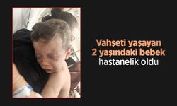 Vahşeti yaşayan 2 yaşındaki bebek hastanelik oldu