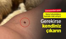 Uzmanından uyarı: Kene tutundukça, hastalık riski artıyor: "Gerekirse kendiniz çıkarın"