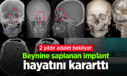 Beynine saplanan implant hayatını kararttı: 2 yıldır adalet bekliyor.