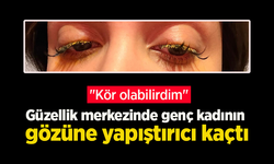 Güzellik merkezinde genç kadının gözüne yapıştırıcı kaçtı: "Kör olabilirdim"