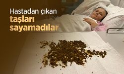 Hastadan çıkan taşları sayamadılar