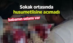 Husumetlisine sokak ortasında acımadı