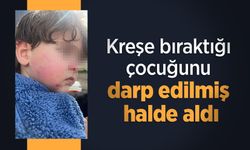 Kreşe bıraktığı çocuğunu darp edilmiş halde aldı