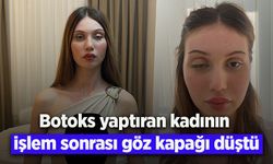 Botoks yaptıran kadının işlem sonrası göz kapağı düştü