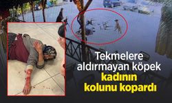 Tekmelere aldırmayan köpek kadının kolunu kopardı