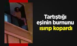 Tartıştığı eşinin burnunu ısırıp kopardı