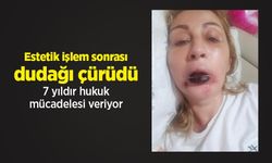 Estetik işlem sonrası dudağı çürüdü, 7 yıldır hukuk mücadelesi veriyor