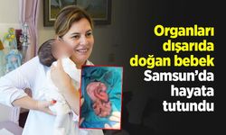 Organları dışarıda doğan bebek, Samsun’da hayata tutundu