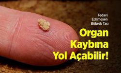 Tedavi Edilmeyen Böbrek Taşı Organ Kaybına Yol Açabilir!