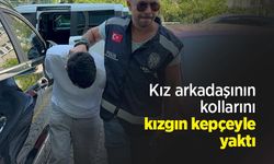 Kız arkadaşının kollarını kızgın kepçeyle yaktı