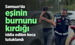 Samsun’da eşinin burnunu kırdığı iddia edilen koca tutuklandı