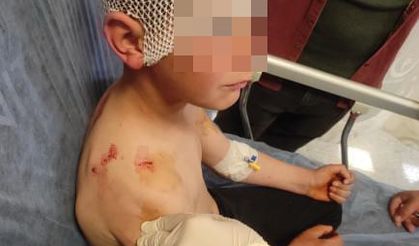 Isparta’da sokakta oynayan çocuğa başıboş köpek saldırdı