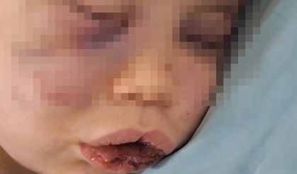 Vahşeti yaşayan 2 yaşındaki bebek hastanelik oldu