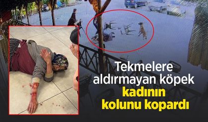 Tekmelere aldırmayan köpek kadının kolunu kopardı