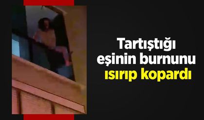 Tartıştığı eşinin burnunu ısırıp kopardı