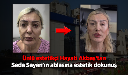 Ünlü estetikçiden Seda Sayan'ın ablasına estetik dokunuş