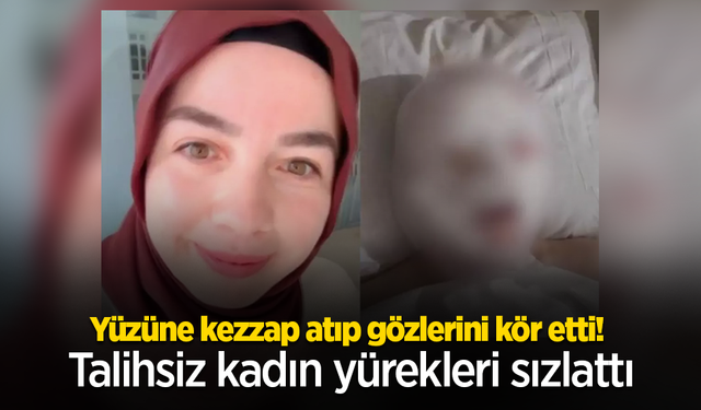 Yüzüne kezzap atıp gözlerini kör etti! Talihsiz kadın yürekleri sızlattı