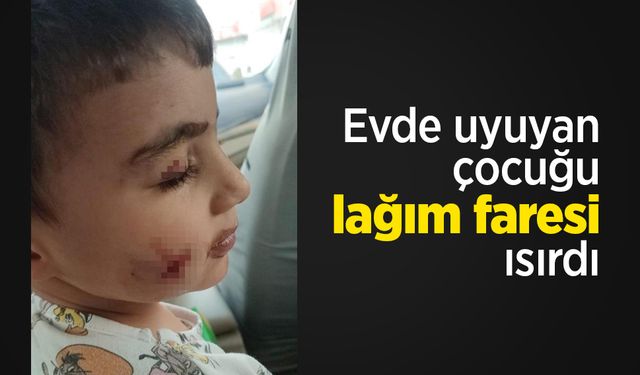 Evde uyuyan çocuğu lağım faresi ısırdı
