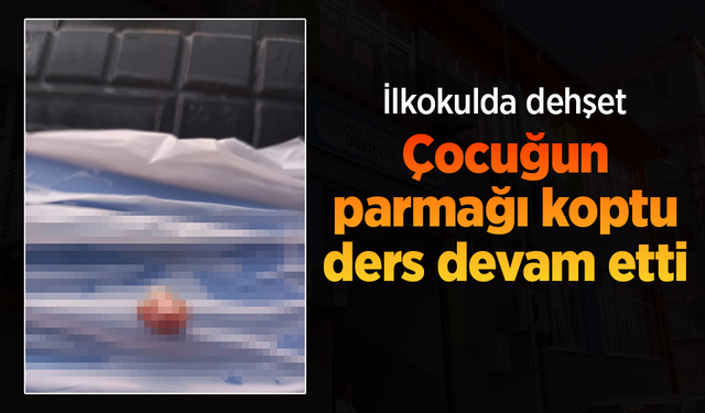 İlkokulda dehşet: Çocuğun parmağı koptu, ders devam etti.