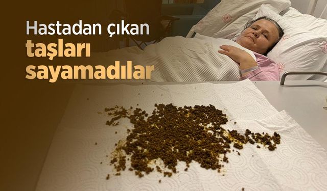 Hastadan çıkan taşları sayamadılar