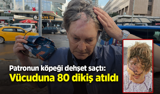 Patronun köpeği dehşet saçtı: Vücuduna 80 dikiş atıldı