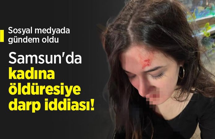 Sosyal medyada gündem oldu! Samsun'da kadına öldüresiye darp iddiası!