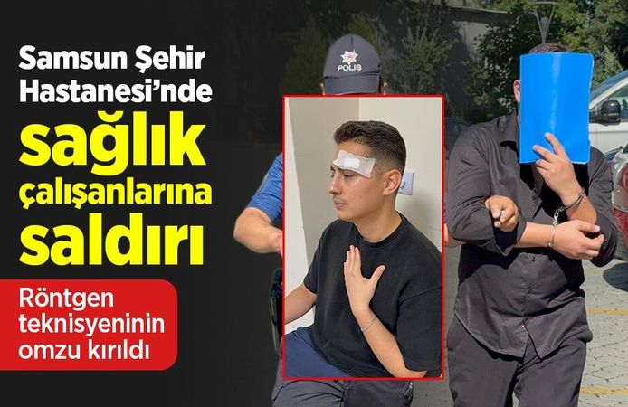 Samsun Şehir Hastanesi’nde sağlık çalışanlarına saldırı: Röntgen teknisyeninin omzu kırıldı